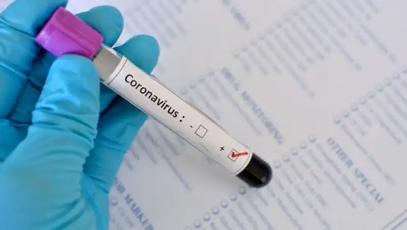 У четверых контактирующих с умершим пациентом в Карагандинской области выявили коронавирус