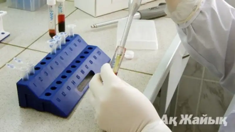 По факту смерти от менингита на Тенгизе будет возбуждено уголовное дело