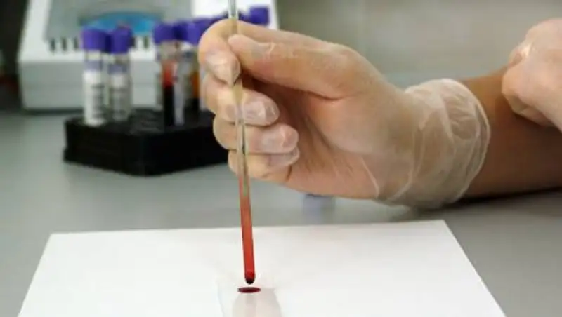 Как образ жизни связан с риском развития рака