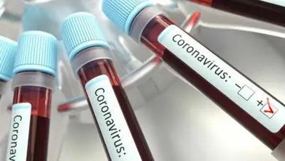 inform.kz, фото - Новости Zakon.kz от 06.04.2020 16:41