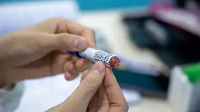 анализы, фото - Новости Zakon.kz от 03.07.2023 17:59