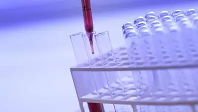 pixabay.com, фото - Новости Zakon.kz от 09.08.2021 11:23