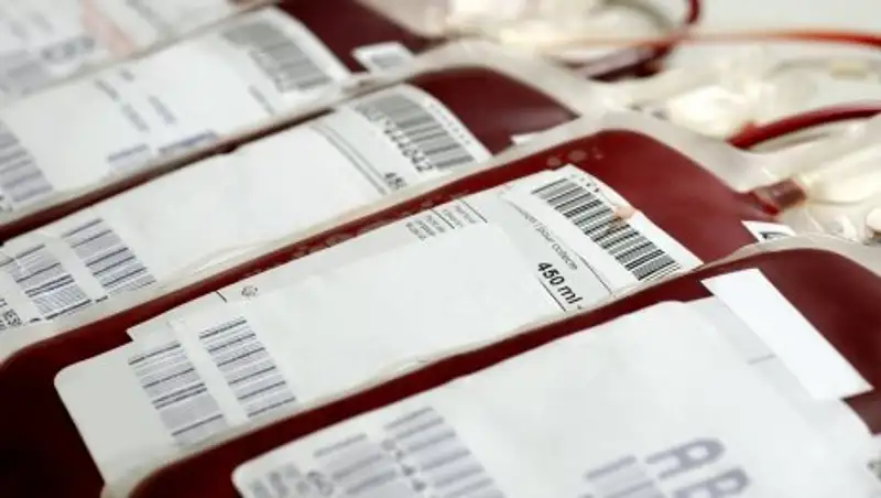 ВИЧ обнаружили у девочки спустя 10 лет после переливания крови