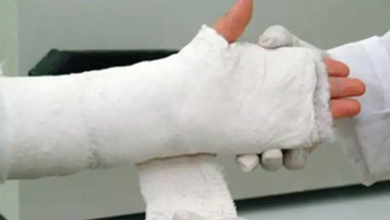 В Экибастузе кондуктор автобуса сломала руку пассажирке