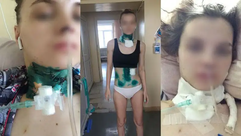 Алматинка рассказала, как муж бил ее ножом на глазах дочери