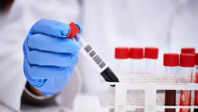 pixabay.com, фото - Новости Zakon.kz от 19.06.2020 14:12