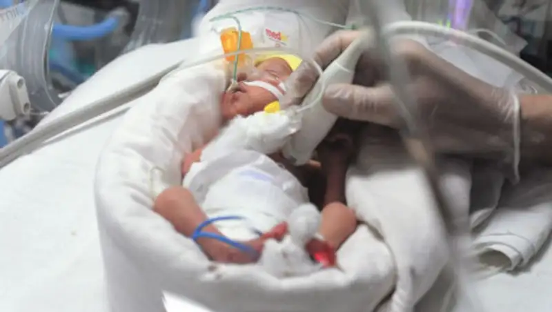 Зараженная коронавирусом родила здорового ребенка, находясь в коме