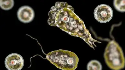 Скончался первый пациент, зараженный амебой, поедающей мозг, фото - Новости Zakon.kz от 27.12.2022 03:50