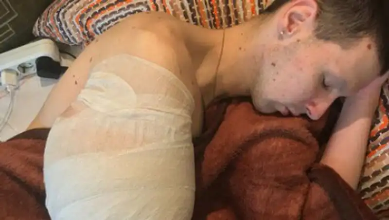 «Руки-базуки» пожаловался на боль и попрощался с подписчиками