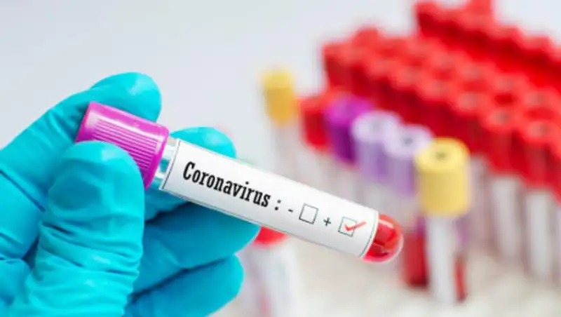 По 150 случаев коронавируса регистрируют в Нур-Султане ежедневно