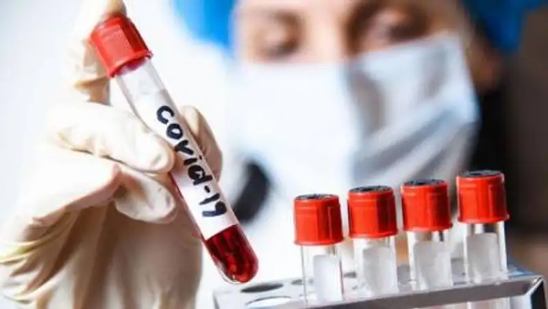 В Казахстане за сутки выявлено свыше 1300 случаев COVID-19