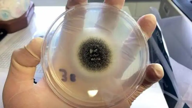 Врач развеял миф о смертельной опасности черной плесени