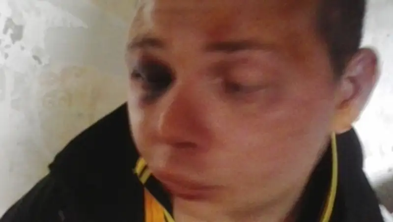 В Темиртау жестоко избили инвалида, требуя 1 млн долларов выкупа