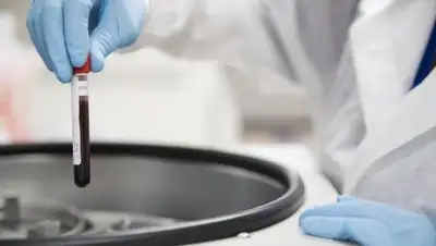 Фото: Likar.info, фото - Новости Zakon.kz от 04.12.2017 15:12