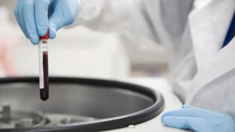 Биртанов: Больных гемофилией не лишали лекарств