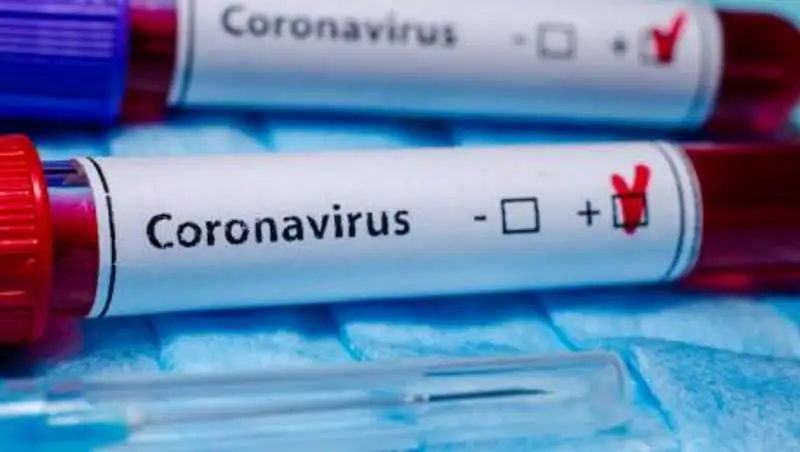 Число заболевших пневмонией казахстанцев продолжает расти