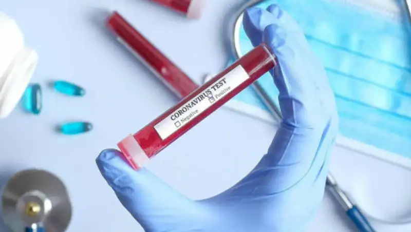 Еще 4 случая заражения коронавирусом в столице