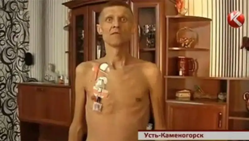 В Усть-Каменогорске мужчина после лечения в больнице остался инвалидом