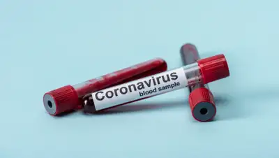 Depositphotos, фото - Новости Zakon.kz от 08.04.2020 13:47