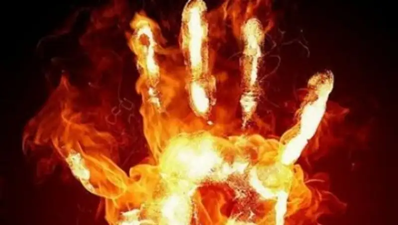 Подросток пытался спасти брата от самоподжога и сам попал в реанимацию