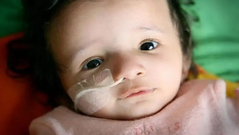 В Казахстане около 1000 детей страдают редкими заболеваниями