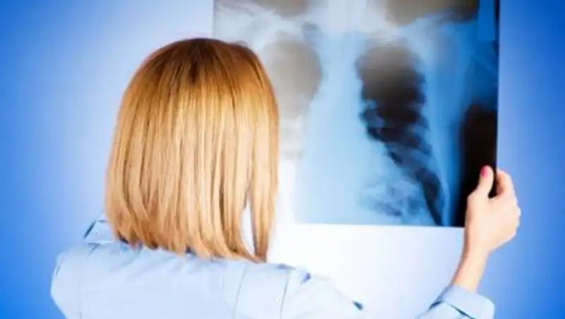 Всего 9 казахстанцев заболели пневмонией