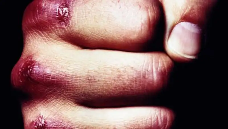 В Костанайской области, разнимая драку, погиб мужчина