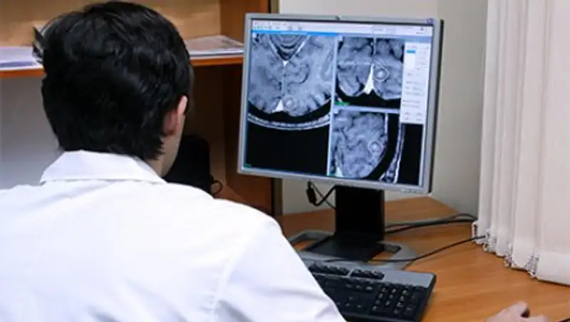 Найдено эффективное средство против рака мозга