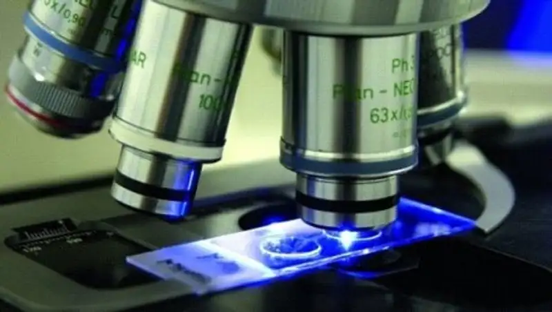 Китайские ученые обнаружили три новых гена, вызывающих рак груди