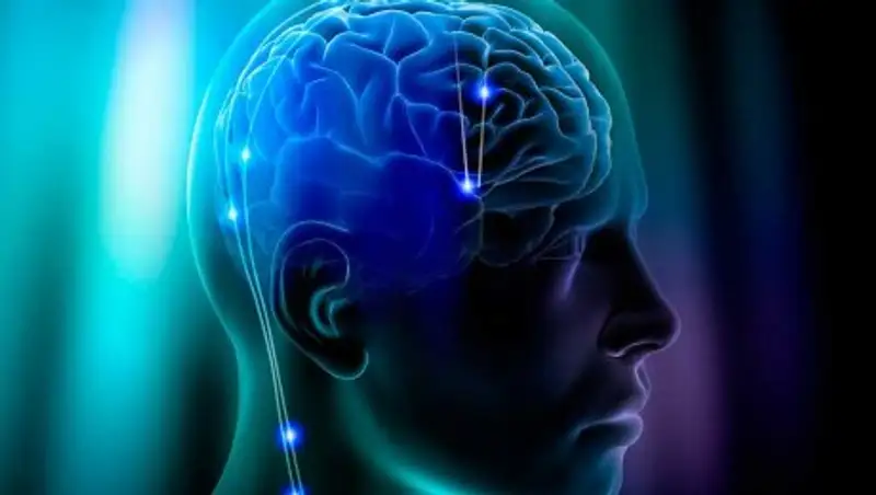 В мозг человека впервые ввели имплант, меняющий настроение