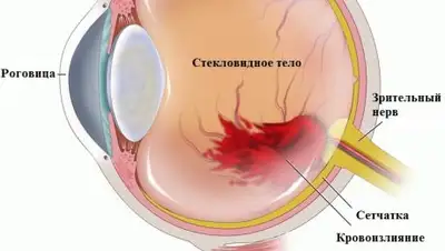 из открытых источников, фото - Новости Zakon.kz от 10.11.2018 14:14