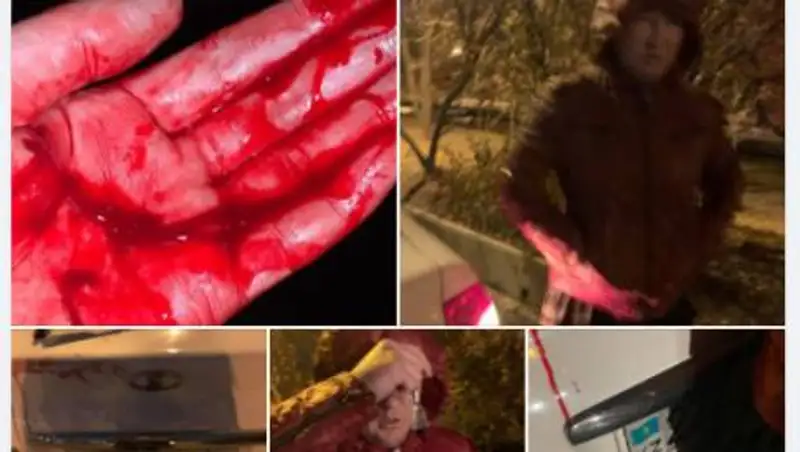 Поднял руку и порезал: Алматинка рассказала о напавшем на нее таксисте