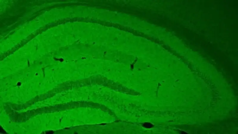 Открыт способ спасения клеток мозга при недосыпе