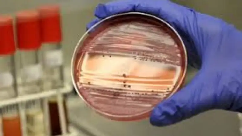 В Северном Казахстане с подозрением на бруцеллёз госпитализированы двое