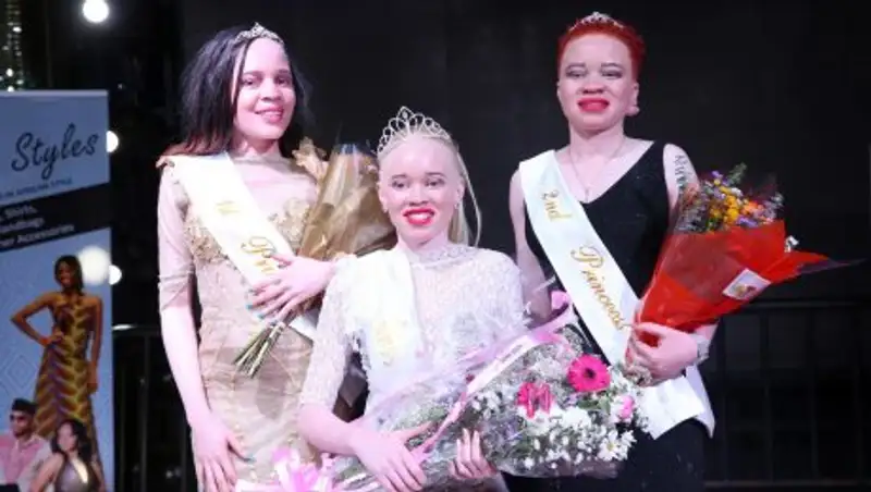 В Зимбабве прошел первый в мире конкурс красоты среди девушек-альбиносов