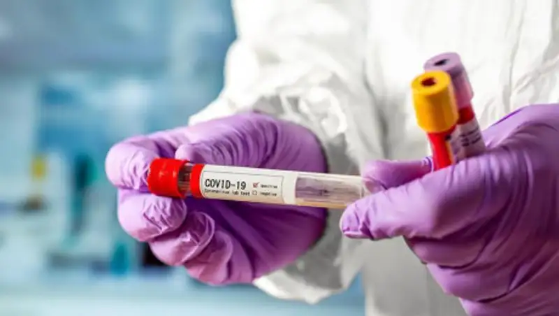 В Казахстане зарегистрированы 439 новых случаев КВИ