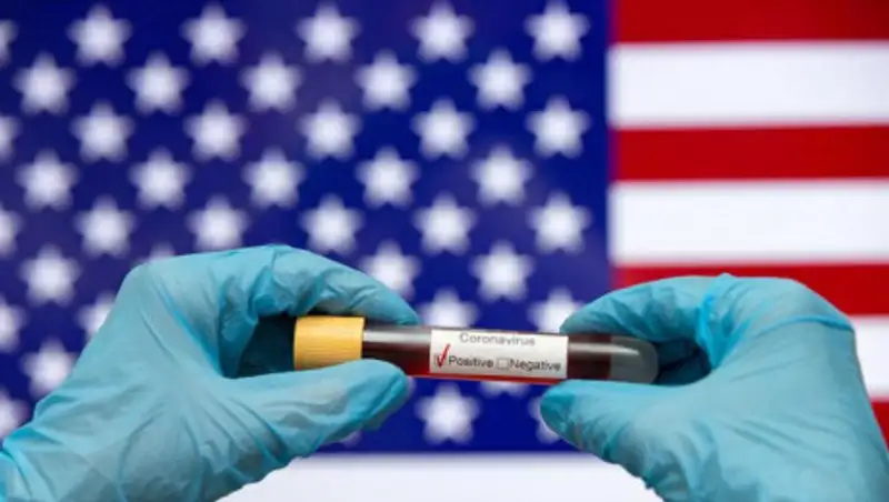 Число погибших от COVID-19 в США превысило 100 тыс. человек