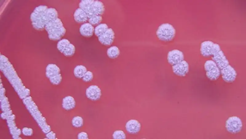 Ученые узнали о заражении смертельно опасной болезнью с одного вдоха