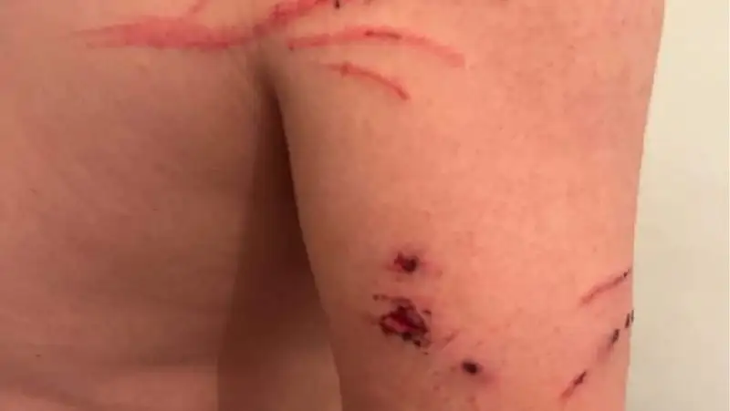 Еще одно нападение тюленя на человека произошло в Актау