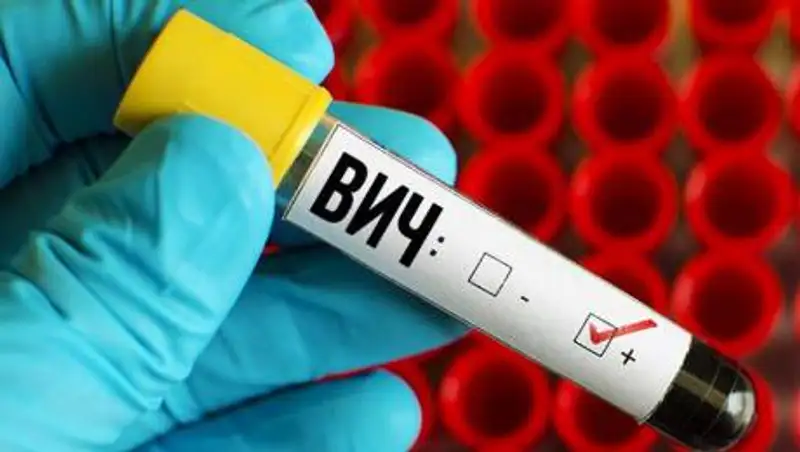 В Казахстане на 43% возросла заболеваемость ВИЧ среди молодежи