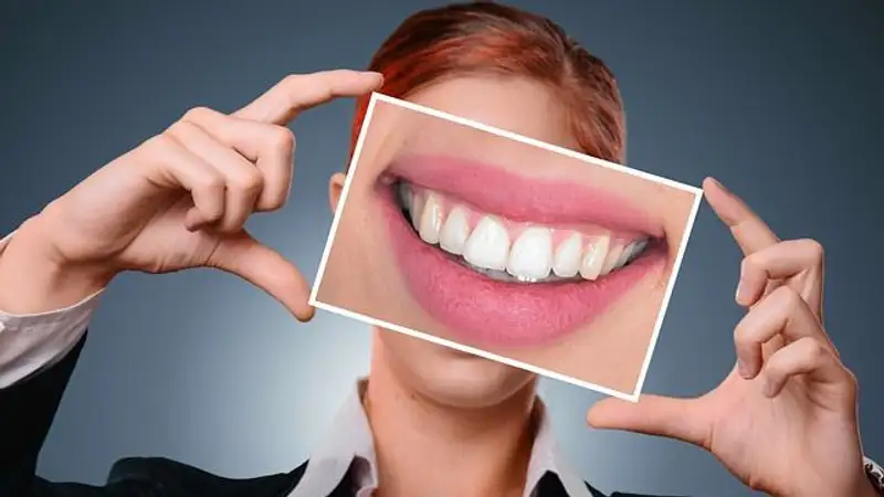 Популярные тренды для зубов, которые могут навредить