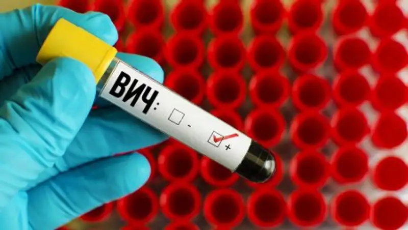 Около 20 ВИЧ-инфицированных скрываются от врачей в Астане