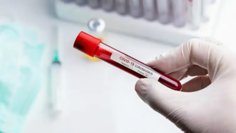 Умершая от COVID-19 жительница ЗКО пять дней не обращалась за медпомощью