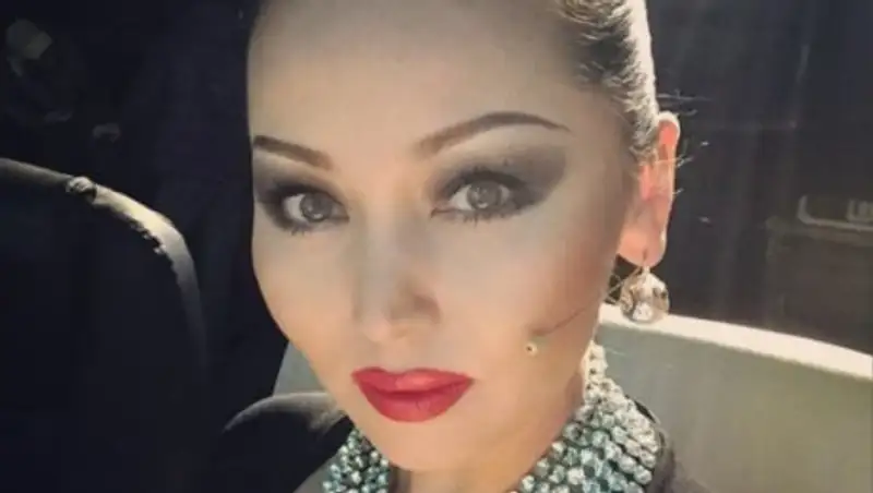 Баян Есентаевой требуется пластика носа