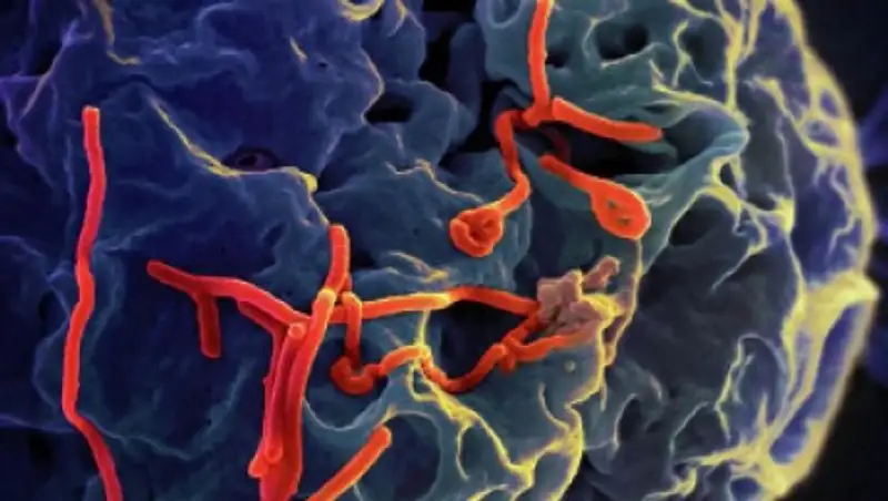 Симптомы лихорадки Эбола у госпитализированного в Алматы не выявлены - Минздрав РФ