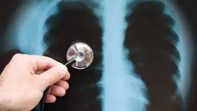 inform.kz, фото - Новости Zakon.kz от 08.09.2020 09:53