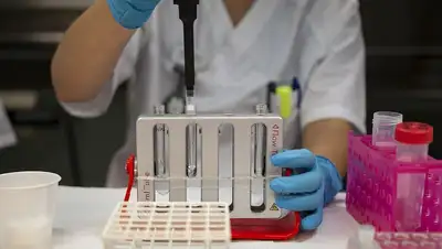 научная работа о факторах заболевания, фото - Новости Zakon.kz от 25.04.2022 11:55