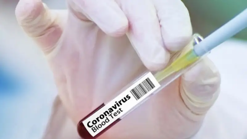 Новые случаи коронавируса в Казахстане – 33 зараженных