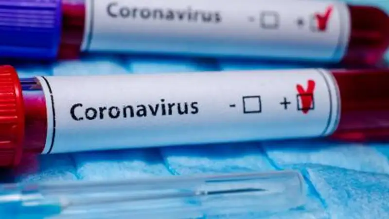 Ученые выяснили сроки, когда тест на COVID-19 наиболее точен