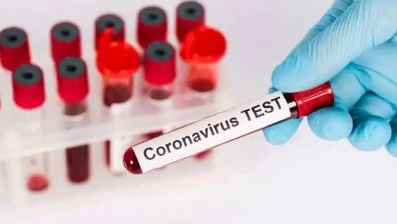 Насколько точны ПЦР-тесты на КВИ, рассказал эксперт